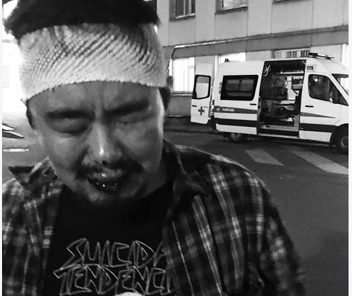 В Москве избили племянника владелицы клиники тибетской медицины «Наран» В Москве избили племянника владелицы клиники тибетской медицины «Наран»